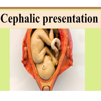meaning of cephalic presentation in marathi